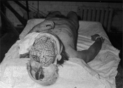 Мозок раба готовий до досліджень. Наступний!(фото з архівів НКВС)